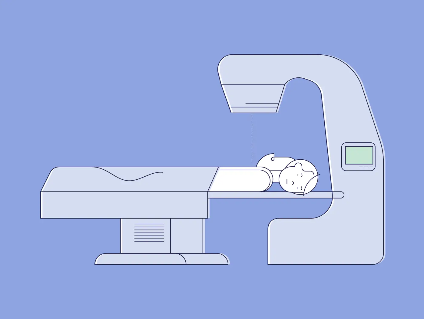 Bestrahlung bei Krebs Illustration